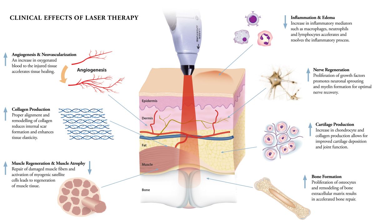 Tissue healing and low level laser article